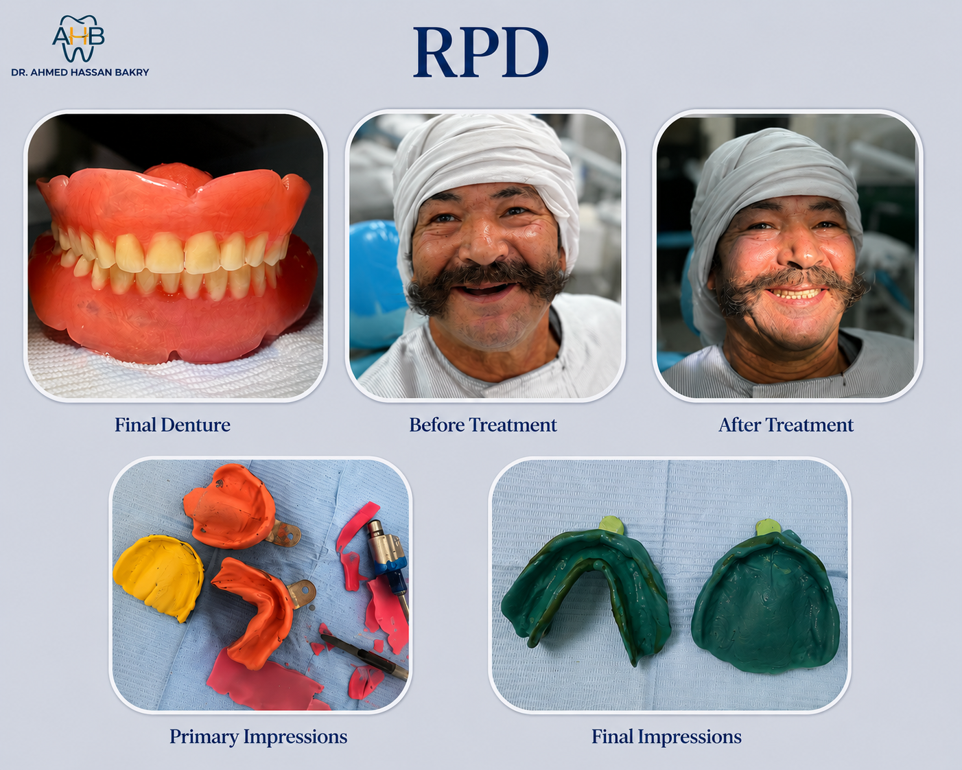 RPD